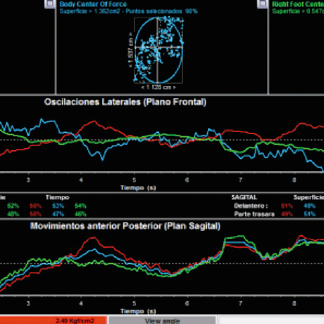 analisis de la pisada