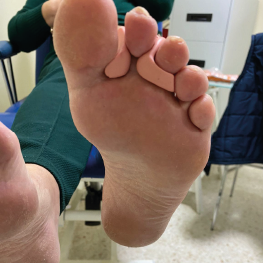 Separador dedos jerez