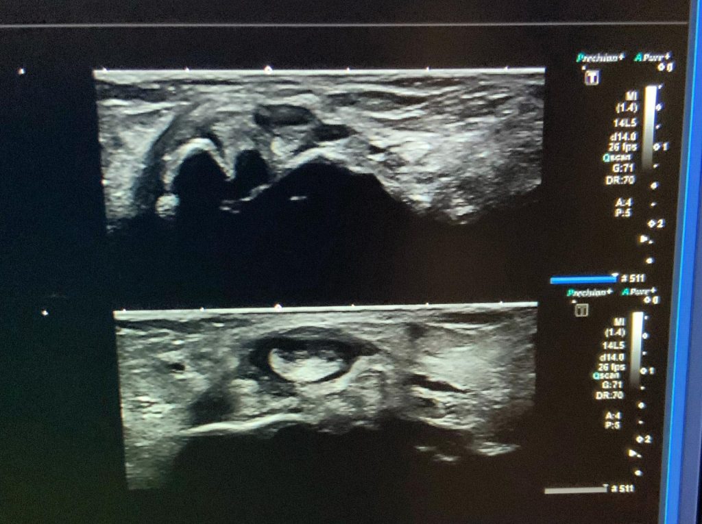 Ecografia pies jerez